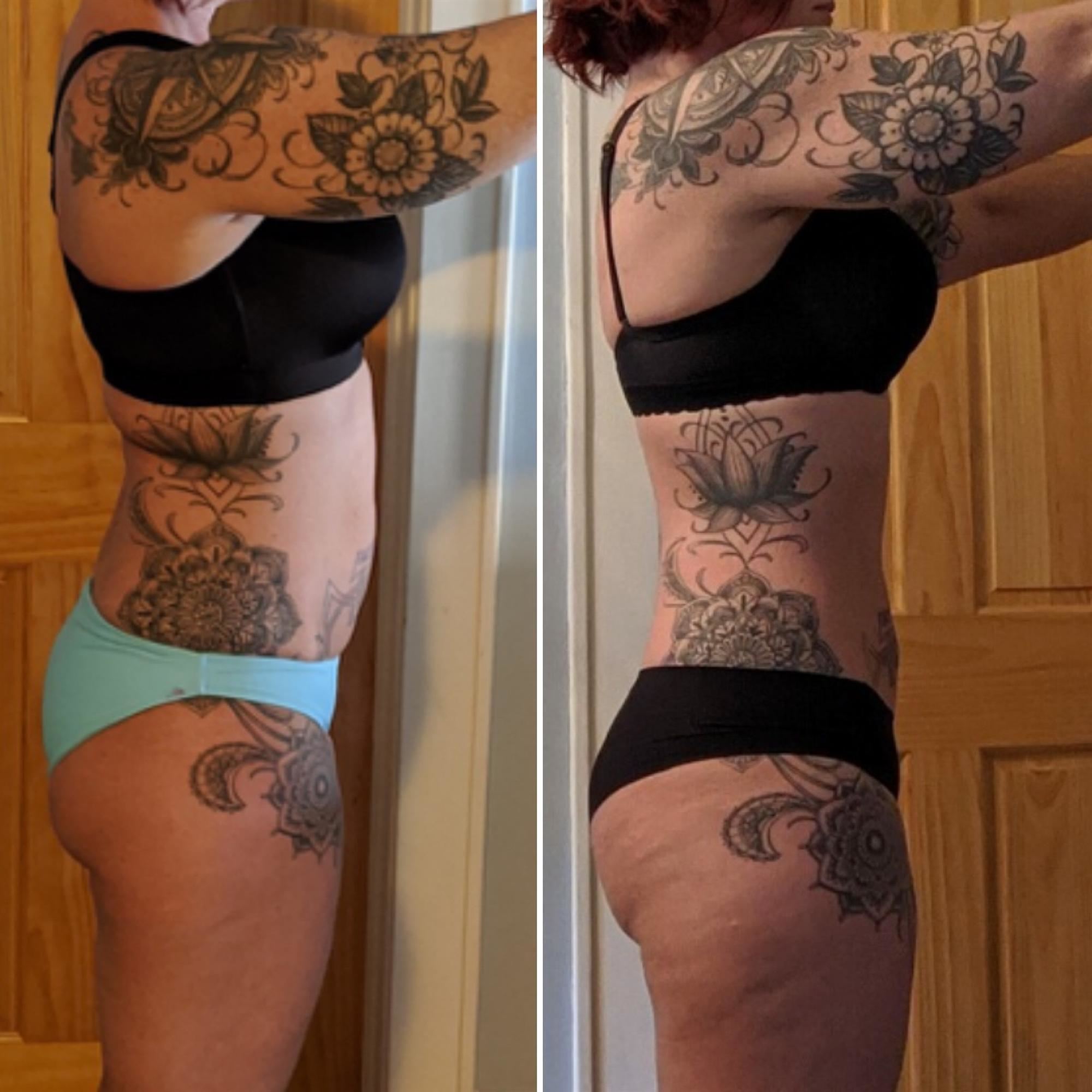 Before & After Results