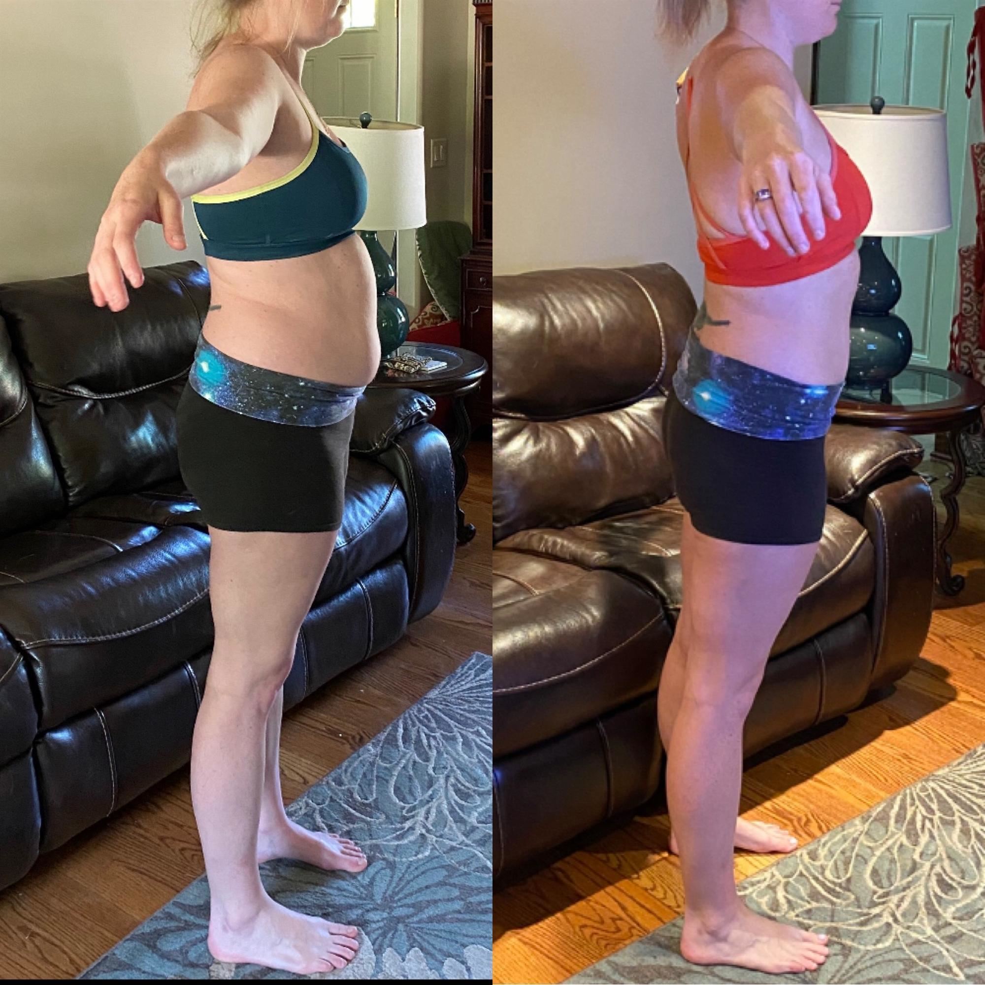 Muscle Toning Before & After Results